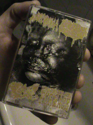 Anal Fissure : Human Stench Rests In The Morgue - Neurofibroma - Anal Fissure - Corpseincinerating Furmace